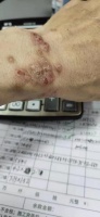 比甲醛还毒的装修致癌物，一定要小心
